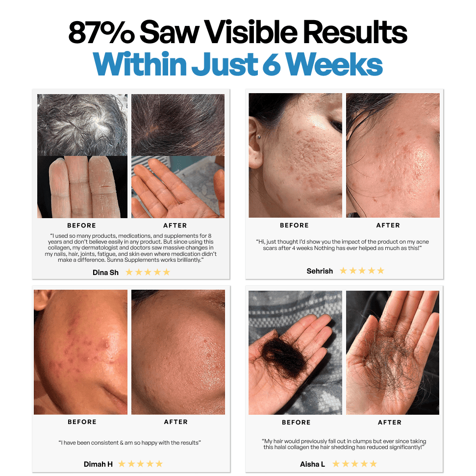 Halal Collagen Protein